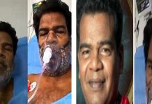 சிறுநீரகக் கோளாறு காரணமாக நடிகர் பொன்னம்பலம் மருத்துவமனையில் அனுமதி