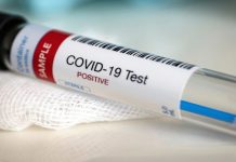 COVID-19: Perak Catat 112 Kes Hari Ini