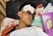 வீட்டு துப்பாக்கி வெடித்ததில் இளைஞர் படுகாயம்