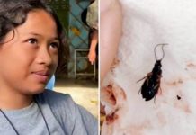 காதில் பூச்சி – இதுதான் பேச்சு