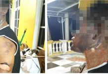Suspek bakar rakan dicari, kes tak bayar hutang RM50