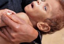 உலகம் முழுவதும் லட்சக்கணக்கான மக்கள் பட்டினியால் இறக்கும் அபாயம்