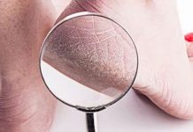 உங்களுக்கு பாத வெடிப்பா கவலை வேண்டாம்