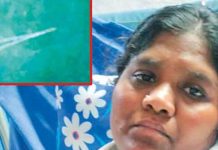பெண்ணின் வயிற்றில் கத்தரிக்கோல்