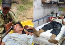 தேனீக்களால் கடுமையாக காயமடைந்த ஆடவர் தீயணைப்பு வீரர்களால் காப்பாற்றப்பட்டார்