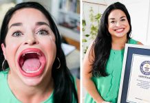 6.52 சென்ரி மீட்டர் அளவிற்கு வாயை திறந்து உலக சாதனை படைத்தார் அமெரிக்காவின் சமந்தா.