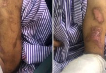 Polis sedang menyiasat dakwaan bahawa gadis dengan Sindrom Down didera