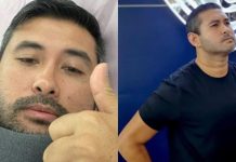 TMJ positif Covid-19