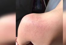 Seorang wanita disyaki memukul kanak-kanak autisme ditangkap