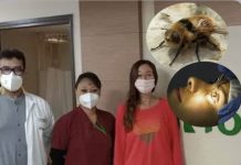 அமெரிக்க பெண் உடலுக்குள் உயிருடன் ஊடுருவிய 3 ஈக்கள்: இந்திய டாக்டர்கள் அகற்றி சாதனை