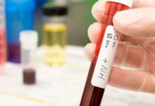 Lebih separuh jangkitan HIV berpunca hubungan seks sejenis