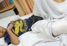 குரங்கு தாக்கியதில் 7 வயது சிறுவன் காயம்; டுங்கூனில் சம்பவம்