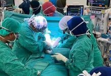 ஒட்டிப்பிறந்த இரட்டையர்களை வெற்றிகரமான பிரித்து HTA வரலாறு படைத்துள்ளது