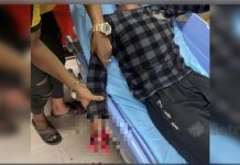 பட்டாசு வெடித்து செவிப்பறையையும் 3 விரல்களையும் இழந்த 2ஆம் படிவ மாணவர்