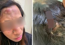 நீதிமன்ற மொழி பெயர்ப்பாளரைத் தாக்கிய சந்தேக நபரை போலீசார் கைது செய்துள்ளனர்