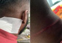 PenjanaKerjaya அறிக்கையின் எதிரொலி; தொண்டூழிய ஆர்வலர் மணிமாறன் தாக்கப்பட்டார்