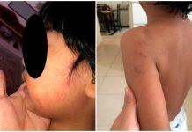 ஆறு வயது ஆட்டிஸ்டிக் சிறுவன் துன்புறுத்தலுக்கு ஆளானதாக கூறப்பட்டதன் தொடர்பில் போலீசார் விசாரணை