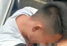 மோட்டார் சைக்கிள் திருட்டு சம்பவத்தின்போது சந்தேக நபர் கைது செய்யப்படுவதை தடுக்கும் போராட்டத்தில் காயமடைந்தார்