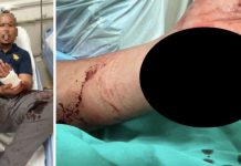 போதைப்பித்தர் பாராங்கத்தியால் வெட்டியதில் இரு போலீஸ்காரர்கள் படுகாயம்