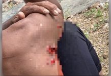 மகனை இழுத்து சென்ற முதலை: காப்பாற்ற சென்ற தந்தைக்கு காயம்