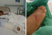 லஹாட் டத்துவில் முதலை தாக்கியதில் 7 வயது சிறுவன் காயமடைந்தான்