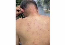 மலையேறுபவரை தாக்கிய தேனீக்கள் கூட்டம்