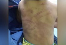 Lelaki disyaki dera anak kekasih ditahan