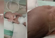 மருத்துவமனையில் செவிலியர் குழந்தையை நழுவ விட்டதால் , குறைமாத குழந்தை தலையில் காயம் அடைந்ததாக தாய் குற்றச்சாட்டு