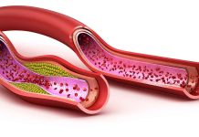 மருந்தே இல்லாமல் உங்க இரத்தத்தில் இருக்கும் கெட்ட கொழுப்பைக் குறைக்கணுமா? இத முயற்சி பண்ணிப் பாருங்க..