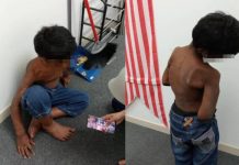 Kerap minum air dalam tandas, tahan sakit dicucuh api – Mangsa dera