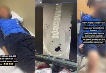 பள்ளியின் குறும்பு விளையாட்டில் (prank) சிக்கி பலத்த காயங்களுடன் படுத்த படுக்கையான மாணவி இக்கா