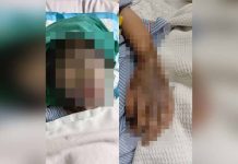 என் மகள் மீது ஆசிட் வீசியது ஏன்? தந்தை வேதனை