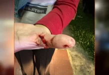 Wanita ditetak ketika bergelut dengan penyamun