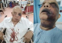 பூச்சோங் சாலையில் பட்டப்பகலில் வயதானவரை தாக்கிய ஆடவர்;தந்தைக்கு முகநூல்வழி உதவி கோரும் மகள்