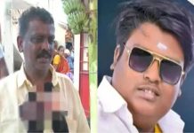 உடல் பருமனைக் குறைக்க அறுவை சிகிச்சை: பறிபோன 26 வயது இளைஞரது உயிர்