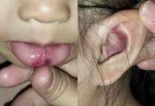 Berang kerana jari digigit – Bayi dicederakan !