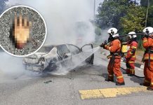 Tangan putus ditemui semasa memadam api dalam kereta