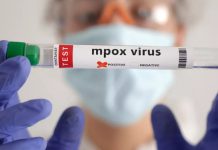 சிங்கப்பூரில் குரங்கு அம்மையால் 13 பேர் பாதிப்பு