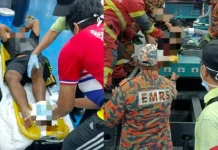 Kaki kiri pekerja kilang terpaksa dipotong selepas tersepit mesin