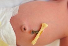 தொப்புள் கொடியுடன் கைவிடப்பட்டிருந்த பெண் குழந்தை – ஈப்போவில் சம்பவம்