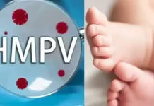 அசாம்:10 மாதக் குழந்தைக்கு எச்.எம்.பி.வி தொற்று