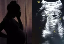 கர்ப்பிணிப் பெண்ணின் வயிற்றில் உள்ள குழந்தைக்குள் வளரும் கரு.. ஆச்சர்யத்தில் மருத்துவர்கள்!