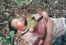 Lelaki parah bergelut dengan beruang