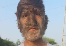 முகம் முழுக்க முடி.. கின்னஸில் இடம்பிடித்த இந்திய இளைஞர்..!