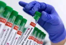 கானாவில் குரங்கம்மை தொற்று பரவல்; 45 பேருக்கு பாதிப்பு உறுதி