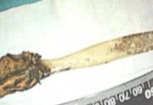 சீனாவின் அன்ஹுய் (Anhui) மாநிலத்தைச் சேர்ந்த 64 வயது யாங் சிறுவயதில் விழுங்கிய பல்துலக்கி தமது உடலில் கண்டுபிடிக்கப்பட்டது