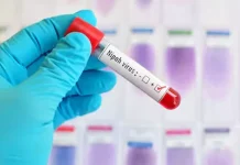 கேரளாவில் நிபா வைரஸுக்கு 2-வது பலி;தடுப்பு நடவடிக்கையில் சுகாதாரத்துறை தீவிரம்