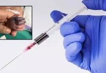 உத்தர பிரதேசம்: மருத்துவமனையில் தவறான ஊசி செலுத்தியதாக குற்றச்சாட்டு – குழந்தையின் கை பறிபோகும் அபாயம்