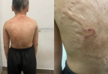 Pasangan suami isteri direman seminggu kerana dera budak