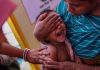 வங்கதேசத்தில் தட்டம்மை நோய்: இந்தியாவுக்கும் தொற்று பரவும் அபாயம்